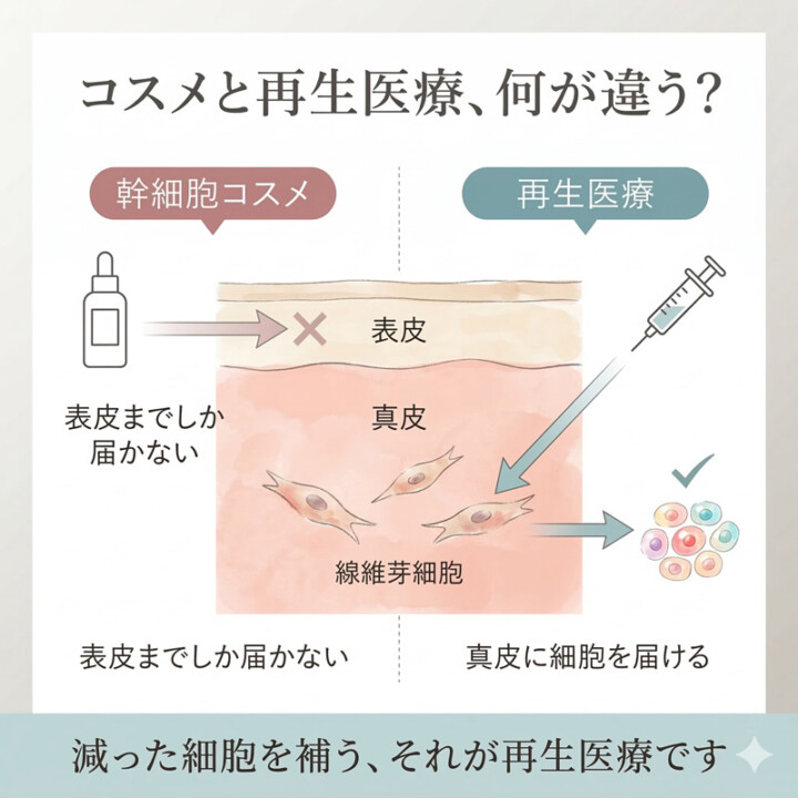 幹細胞コスメと再生医療の違いを図解したインフォグラフィック：化粧品が肌表面の保湿に留まるのに対し、線維芽細胞療法が真皮層に細胞を補充する仕組みの対比図